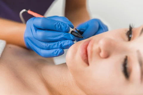 Electrolysists in demand - Up-skill & Qualify image